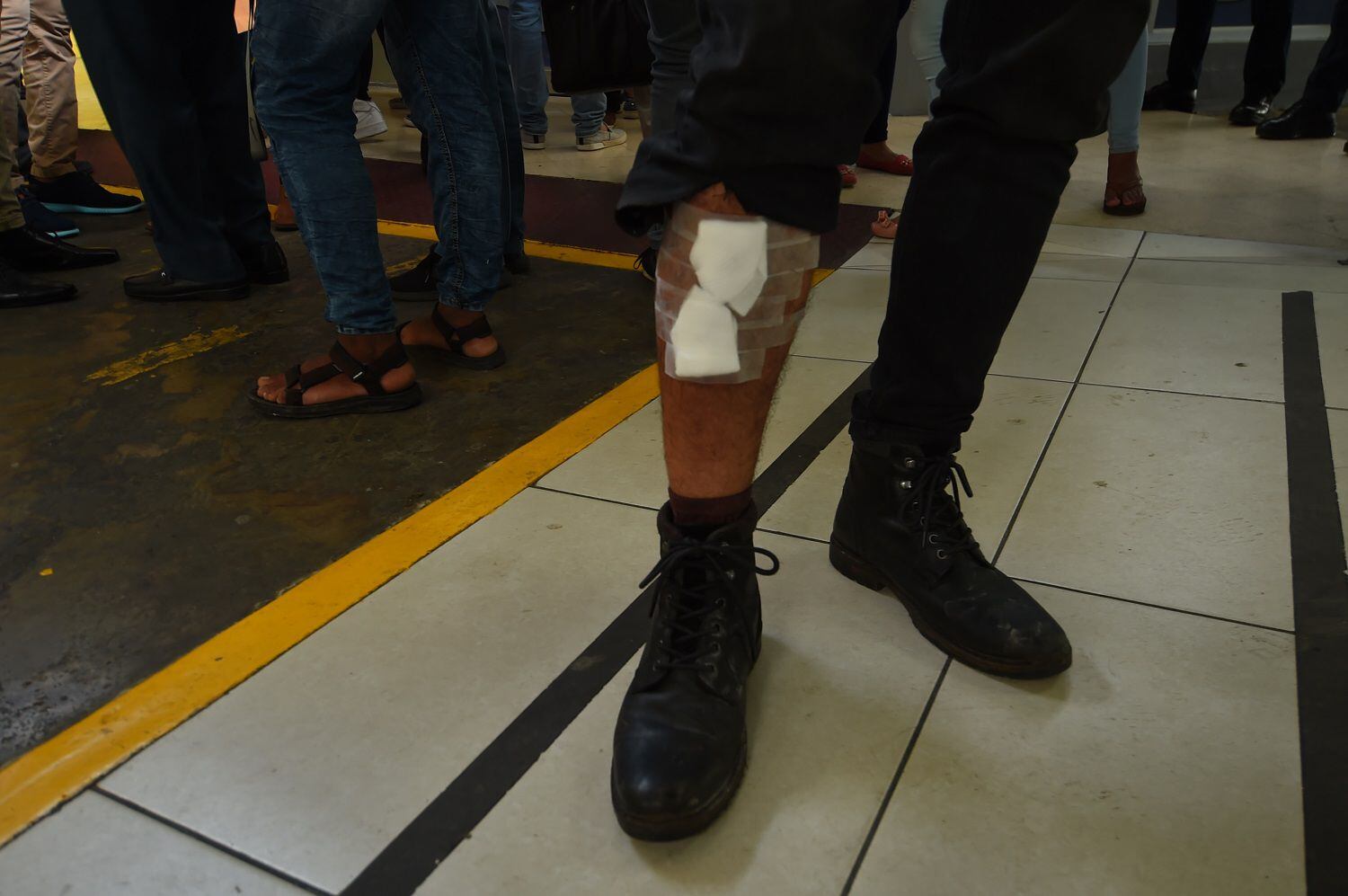 'A un muchacho le rompieron la pierna a toletazos', un relato desde el corazón de la protesta contra las reformas