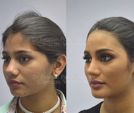 La impresionante transformación facial de Sthefany Gutiérrez, Miss Venezuela