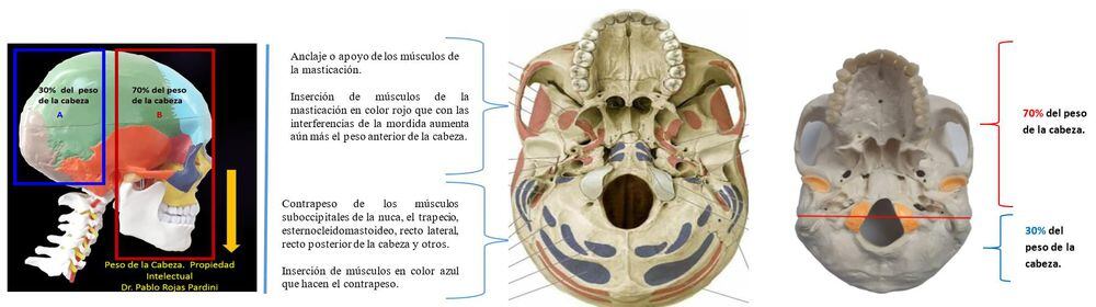 Mordida disfuncional: causa de algunas enfermedades de origen desconocido, donde aplica